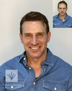 Absolute Image Consulting Hair Replacement