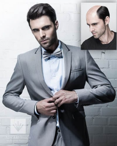 Absolute Image Consulting Hair Replacement