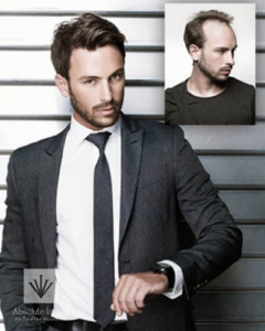 Absolute Image Consulting Hair Replacement
