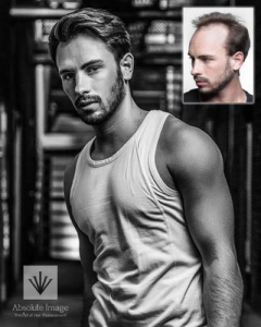 Absolute Image Consulting Hair Replacement